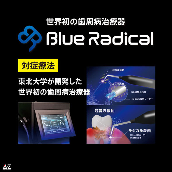世界初の歯周病治療器 Blue Radical(ブルーラジカル)。対症療法。東北大学が開発した世界初の歯周病治療器。超音波振動、3%過酸化水素、405nm青色レーザーによるラジカル殺菌の仕組み